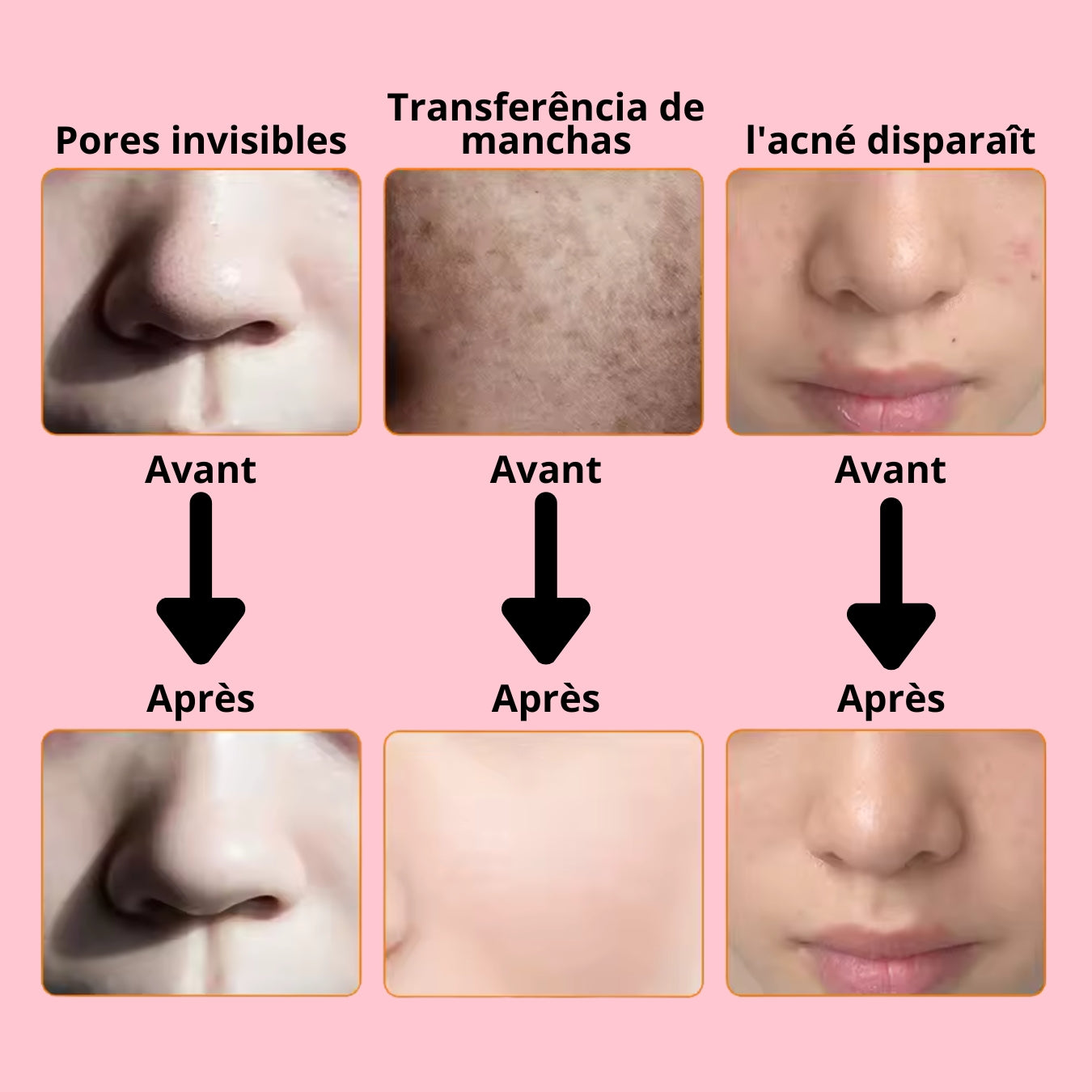 Masque facial LED 2 en 1 - 7 options LED